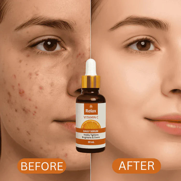 Relax Vitamin C Serum 30ml | Brightening, Firming & Even Skin Tone