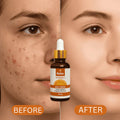 Relax Vitamin C Serum 30ml | Brightening, Firming & Even Skin Tone